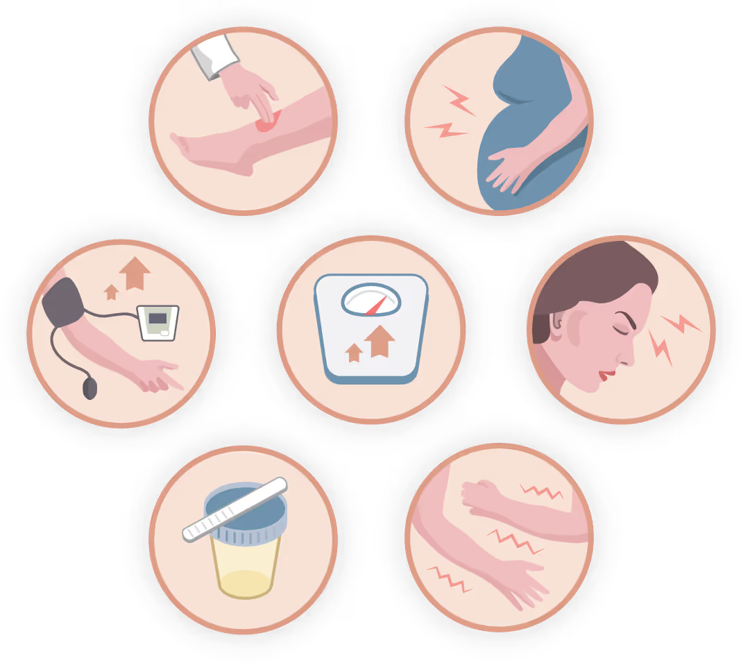 Seven circular illustrations of preeclampsia symptoms and checks, including swelling, blood pressure, weight gain, headache and a urine test